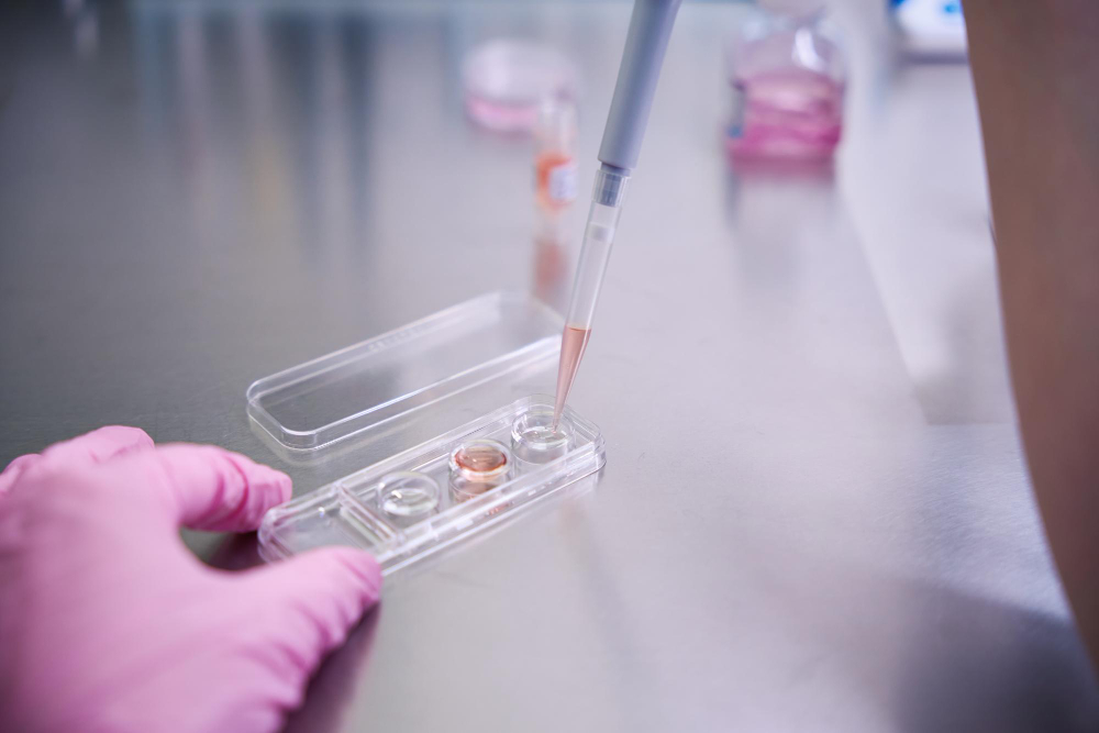 CAR-T Cell Therapy: Η Γενετική Επανεκπαίδευση του Ανοσοποιητικού Συστήματος στη Μάχη κατά του Καρκίνου